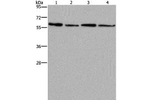 Western Blot analysis of Mouse kidney, liver, heart and brain tissue using CD297 Polyclonal Antibody at dilution of 1:667 (ART4 antibody)
