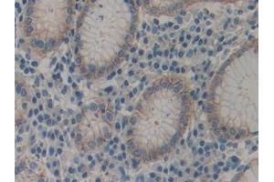 Immunohistochemistry (IHC) image for anti-Actinin, alpha 4 (ACTN4) (AA 1-269) antibody (ABIN7440797)
