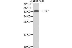 Western blot analysis of extracts of Jurkat cell lines, using TBP antibody. (TBP antibody  (AA 1-100))