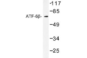 Image no. 1 for anti-Activating Transcription Factor 6 beta (ATF6B) antibody (ABIN272250)