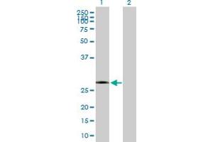 Western Blot analysis of KCTD15 expression in transfected 293T cell line by KCTD15 MaxPab polyclonal antibody.