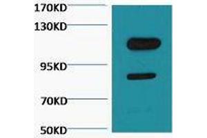 Western Blot (WB) analysis of Jurkat, diluted at 1:3000. (PARP1 antibody  (cleaved))