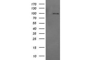 Image no. 2 for anti-Phosphoinositide-3-Kinase, Regulatory Subunit 5 (PIK3R5) antibody (ABIN1500212) (PIK3R5 antibody)