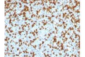 Formalin-fixed, paraffin-embedded human Tonsil stained with PD1 (CD279) Rabbit Recombinant Monoclonal Antibody (PDCD1/1410R). (Recombinant PD-1 antibody)