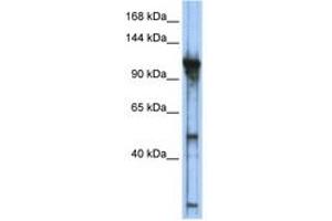 Image no. 1 for anti-General Transcription Factor IIIC, Polypeptide 2, beta 110kDa (GTF3C2) (AA 755-804) antibody (ABIN6742236) (GTF3C2 antibody  (AA 755-804))