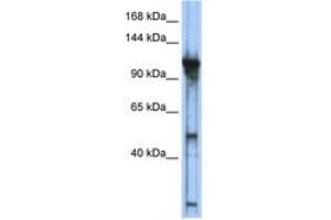 Image no. 1 for anti-General Transcription Factor IIIC, Polypeptide 2, beta 110kDa (GTF3C2) (AA 755-804) antibody (ABIN6742236)