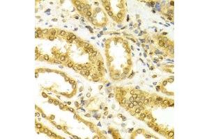Immunohistochemistry (IHC) image for anti-Lamin B1 (LMNB1) (AA 397-586) antibody (ABIN3015698)