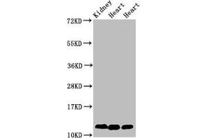 Western Blot Positive WB detected in: Rat kidney tissue, Rat heart tissue, Mouse heart tissue All lanes: CYCS antibody at 2 μg/mL Secondary Goat polyclonal to rabbit IgG at 1/50000 dilution Predicted band size: 12 kDa Observed band size: 12 kDa (Cytochrome C antibody  (AA 2-105))