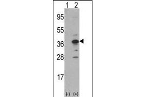 Western blot analysis of MCA1(arrow) using rabbit polyclonal MCA1 Antibody (N-term) (ABIN390679 and ABIN2840973). (MCA1 antibody  (C-Term))