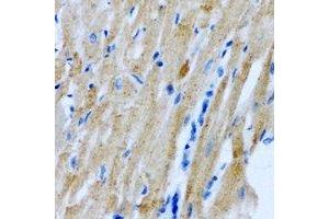 Immunohistochemical analysis of Myomegalin staining in rat heart formalin fixed paraffin embedded tissue section. (PDE4DIP antibody)