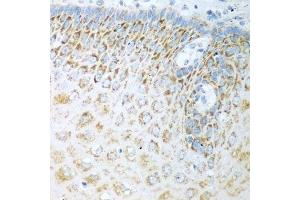 Immunohistochemistry of paraffin-embedded human esophagus using FDXR antibody.