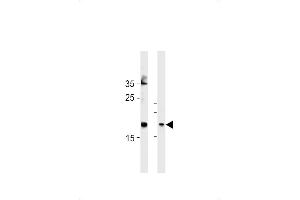 FA Antibody (Center) (ABIN1881332 and ABIN2843378) western blot analysis in Hela cell line and mouse bladder tissue lysates (35 μg/lane). (FAM159A antibody  (AA 89-115))