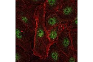 Immunofluorescence analysis of U251 cells using c-Rel mouse mAb (green). (c-Rel antibody)