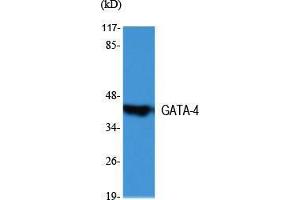 Western Blot (WB) analysis of specific cells using GATA-4 Polyclonal Antibody. (GATA4 antibody  (Internal Region))