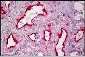 Human Kidney, Tubules: Formalin-Fixed, Paraffin-Embedded (FFPE) (GPR101 antibody  (C-Term))