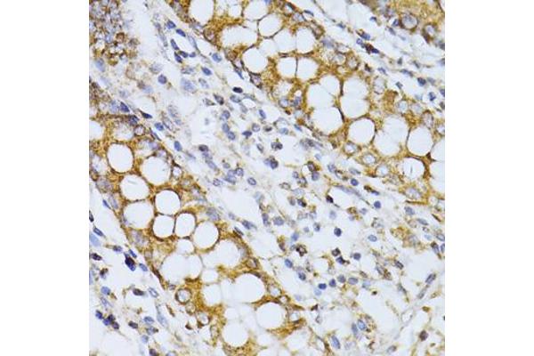 CCDC92 antibody