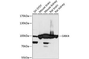 Western blot analysis of extracts of various cell lines, using GRIK4 antibody (ABIN6127977, ABIN6141396, ABIN6141397 and ABIN6217924) at 1:3000 dilution. (GRIK4 antibody  (AA 21-220))