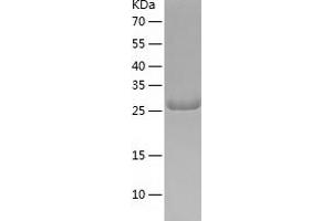 Western Blotting (WB) image for Protein Kinase, AMP-Activated, alpha 1 Catalytic Subunit (PRKAA1) (AA 1-279) protein (His tag) (ABIN7124657) (PRKAA1 Protein (AA 1-279) (His tag))