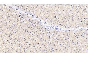 Detection of TYR in Porcine Liver Tissue using Polyclonal Antibody to Tyrosinase (TYR) (TYR antibody  (AA 5-245))