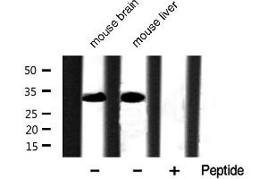 Western blot analysis of extracts of various tissue sample,using Phospho-Caspase 3 (Ser150) Antibody . (Caspase 3 antibody  (pSer150))