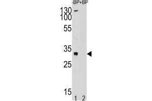 Western Blotting (WB) image for anti-Testis Specific Protein, Y-Linked 1 (TSPY1) antibody (ABIN2995165) (TSPY1 antibody)