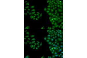 Immunofluorescence analysis of HeLa cells using NEFL antibody. (NEFL antibody)