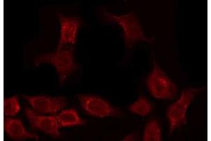 ABIN6267262 staining SK-OV3 by IF/ICC. (EGFR antibody  (pTyr1097))