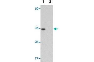 Western blot analysis of rat brain tissue with SYNGR1 polyclonal antibody  at 1 ug/mL in (Lane 1) the absence and (Lane 2) the presence of blocking peptide.