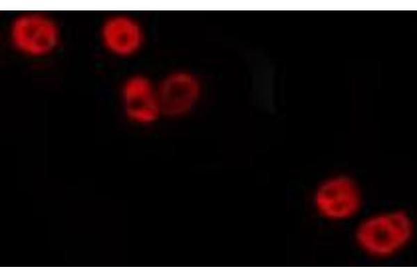 NACAD antibody  (N-Term)