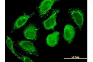 Immunofluorescence of monoclonal antibody to CALM2 on HeLa cell. (Calmodulin 2 antibody  (AA 1-149))