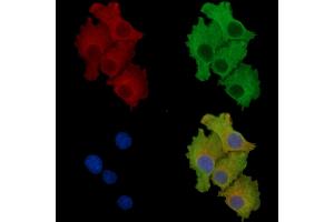 ABIN7096855 and ABIN7100921 staining HepG2 cells by IF/ICC. (PAPD1 antibody)