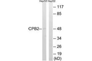 Western blot analysis of extracts from HepG2 cells, using CPB2 Antibody. (CPB2 antibody  (AA 321-370))
