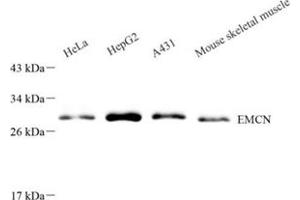 Western blot analysis of EMCN (ABIN7073818) at dilution of 1: 500 (Endomucin antibody)