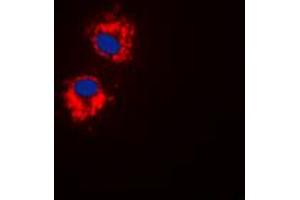 Immunofluorescent analysis of EG5 (pT926) staining in HepG2 cells. (KIF11 antibody  (C-Term, pSer926))