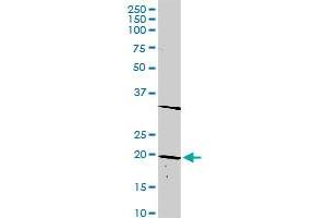 DLX6 MaxPab rabbit polyclonal antibody. (DLX6 antibody  (AA 1-175))
