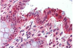 Human Colon (formalin-fixed, paraffin-embedded) stained with ITGA6 antibody ABIN462312 followed by biotinylated goat anti-rabbit IgG secondary antibody ABIN481713, alkaline phosphatase-streptavidin and chromogen. (ITGA6 antibody  (Ser1064))