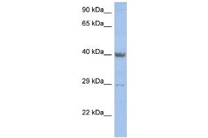 WB Suggested Anti-ZNF474 Antibody Titration: 0. (ZNF474 antibody  (Middle Region))