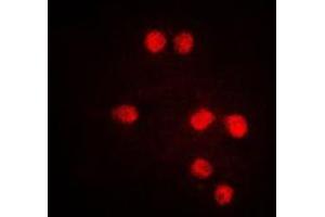 Immunofluorescent analysis of TEL staining in Jurkat cells.