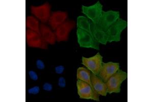 ABIN6258916 and ABIN6275149 staining Hela cells(24h of starvation treatment) by IF/ICC. (GJB7 antibody  (C-Term))