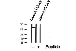 SLC10A2 antibody  (C-Term)