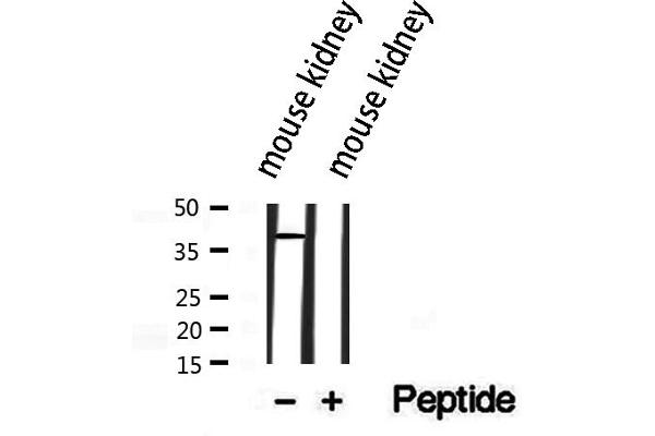 SLC10A2 antibody  (C-Term)