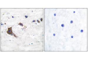 Immunohistochemistry (IHC) image for anti-Hydroxysteroid (17-Beta) Dehydrogenase 10 (HSD17B10) (Internal Region) antibody (ABIN1848526) (HSD17B10 antibody  (Internal Region))