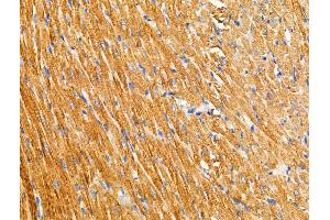 ABIN6257944 and ABIN6274861 at 1/100 staining Rat heart tissue by IHC-P.