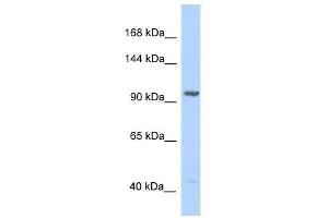 Western Blot showing IDE antibody used at a concentration of 1.