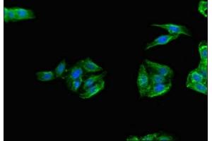Immunofluorescent analysis of HepG2 cells using ABIN7172328 at dilution of 1:100 and Alexa Fluor 488-congugated AffiniPure Goat Anti-Rabbit IgG(H+L) (TANK antibody  (AA 4-98))