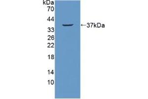 Figure. (NUP214 antibody  (AA 601-868))