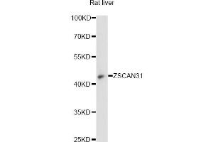 Western blot analysis of extracts of rat liver, using ZSCAN31 antibody (ABIN6294106) at 1:3000 dilution. (ZKSCAN2 antibody)