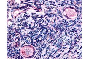 Immunohistochemical (Formalin/PFA-fixed paraffin-embedded sections) staining in human ovary (oocytes) with TMEM5 polyclonal antibody . (TMEM5 antibody)