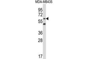 Western Blotting (WB) image for anti-Zinc Finger Protein 479 (ZNF479) antibody (ABIN5017203) (ZNF479 antibody)