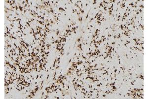 ABIN6272431 at 1/100 staining Human gastric tissue by IHC-P. (SIN3B antibody  (Internal Region))